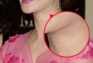 明星真的没有颈纹吗,揭秘明星无颈纹的护肤秘诀